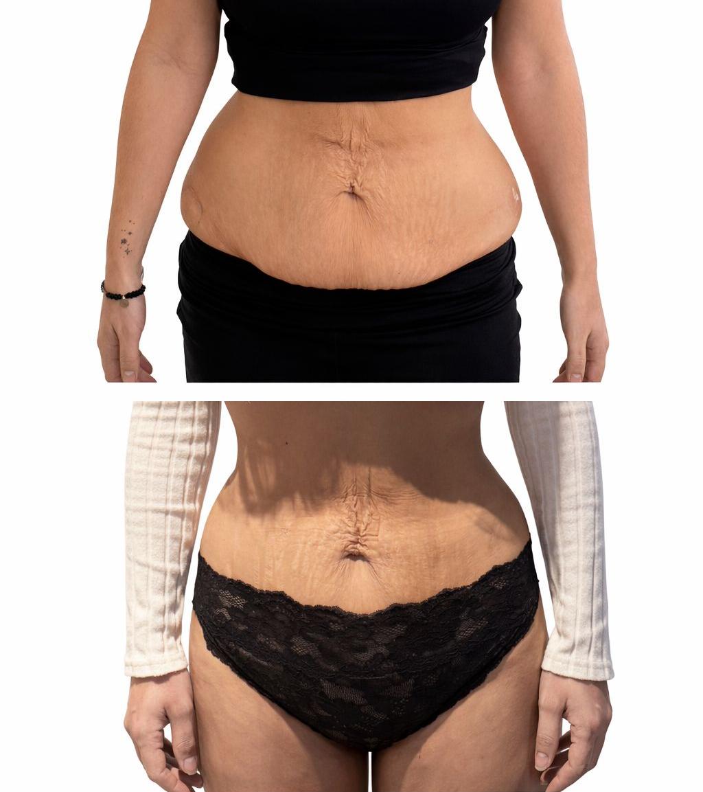 Before and after transformation results