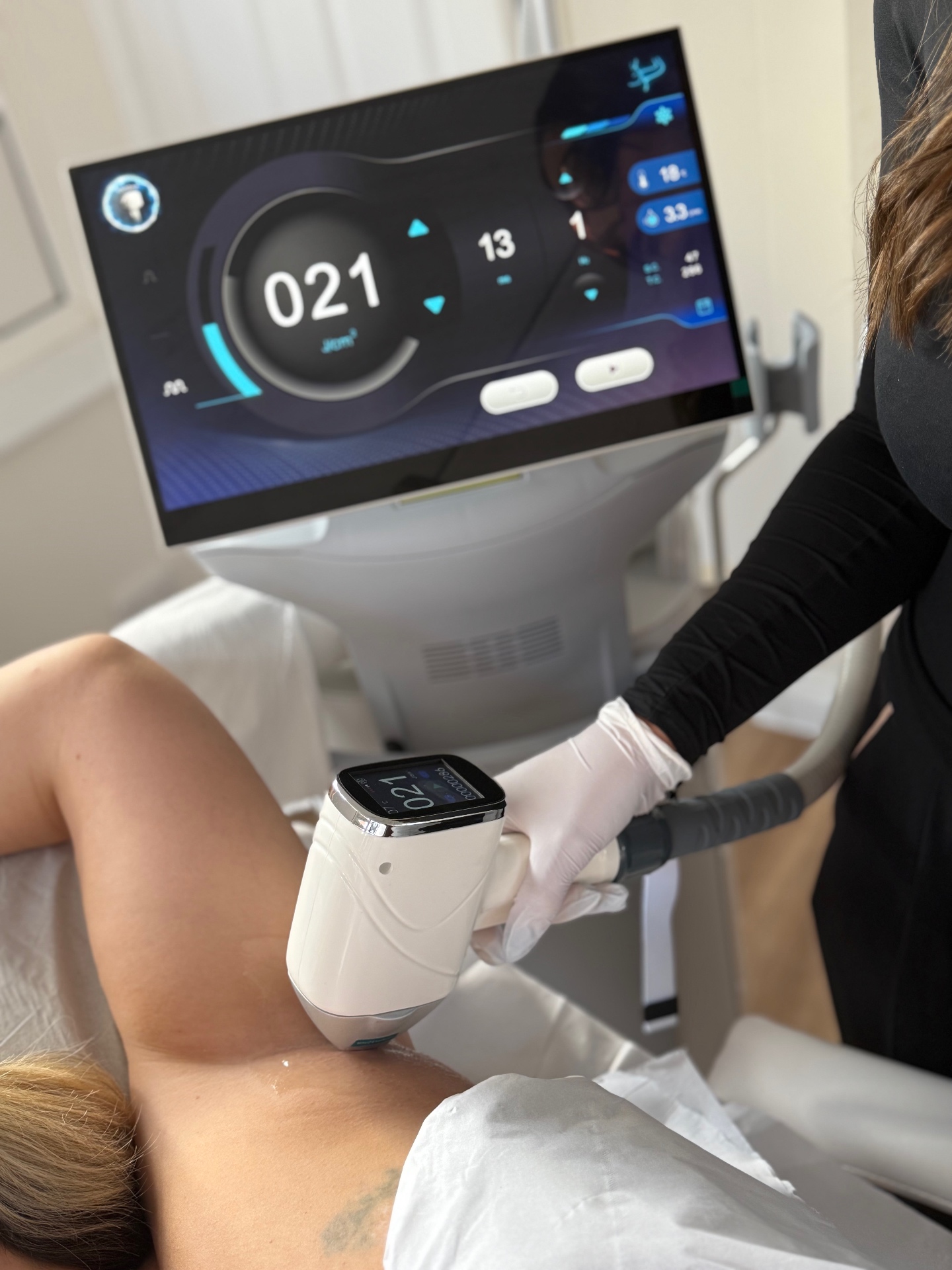 Laser Hair Removal