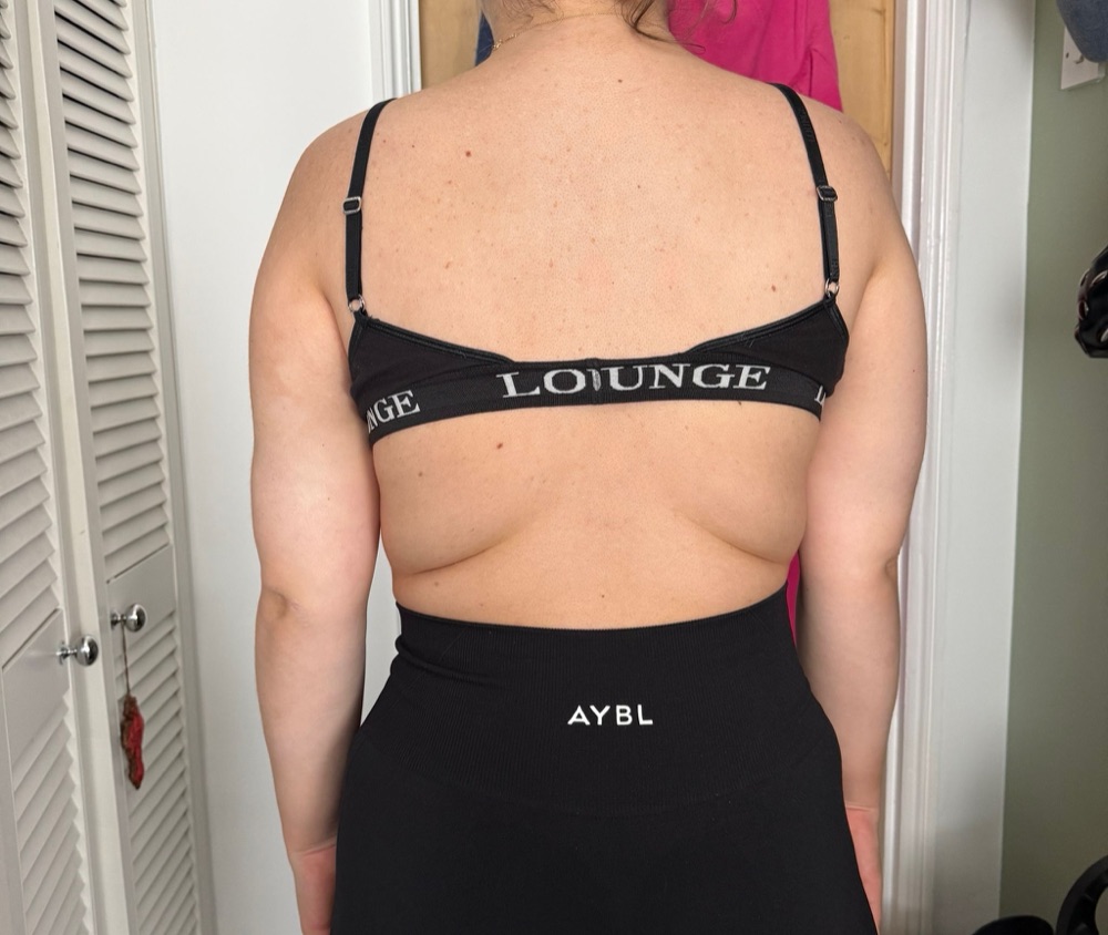 After treatment