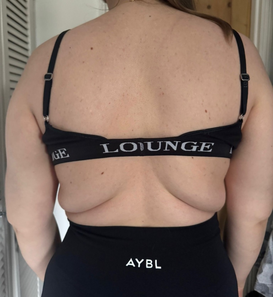 Before treatment