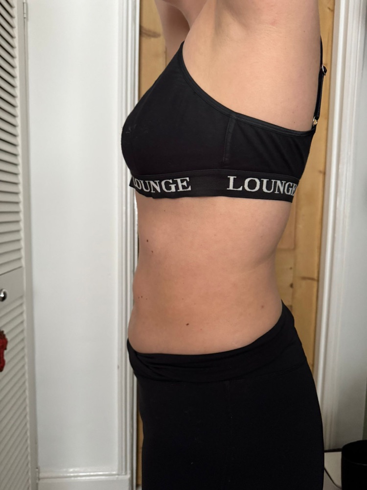 After treatment