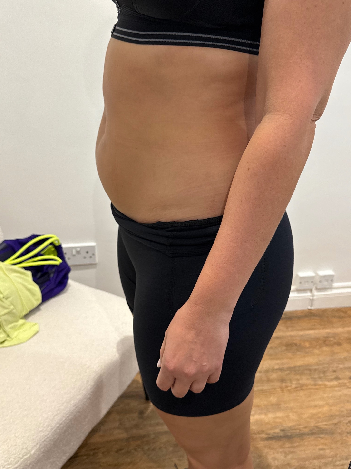 After treatment