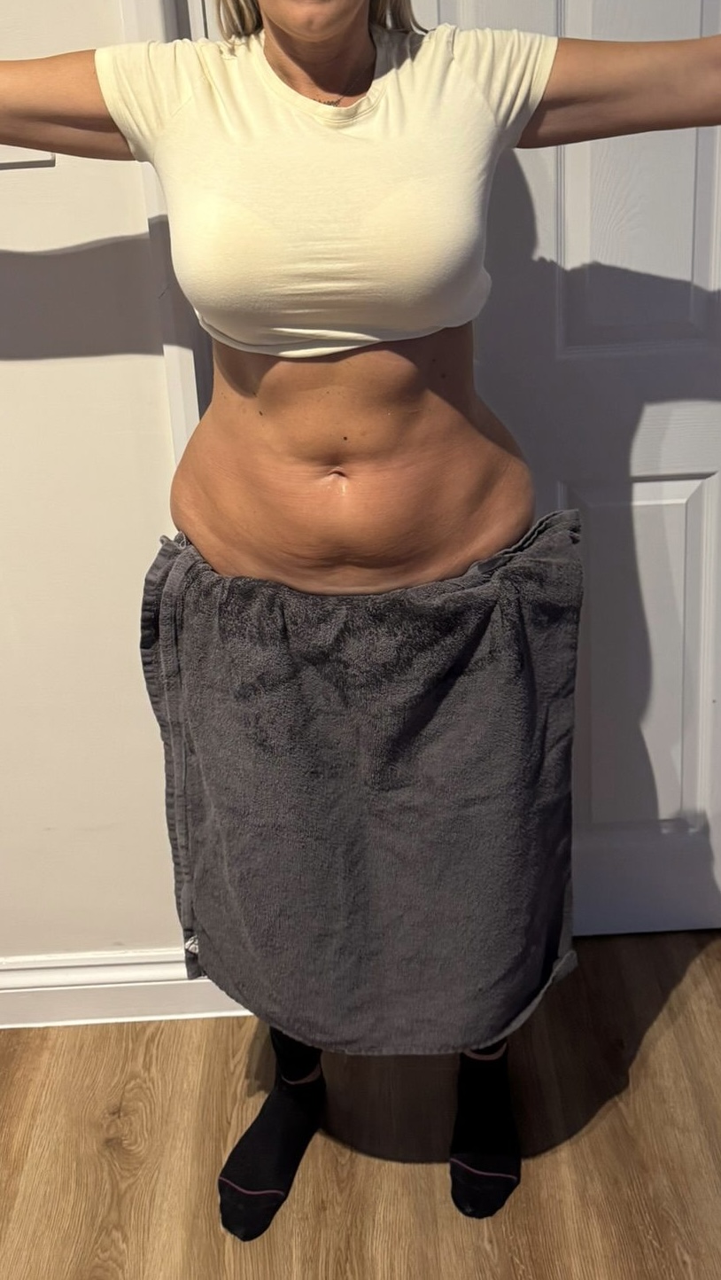 Before treatment