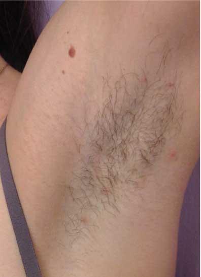 Before treatment
